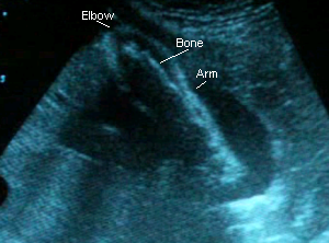 Just as she was reaching towards her face.