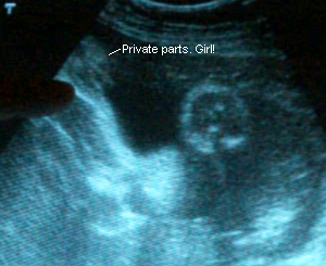 Finally! A picture of her little peach!