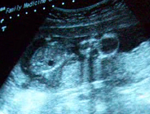 The baby's face and tummy!